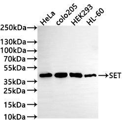 Western Blot
Positive WB detected in: HeLa whole cell lysate(30µg) , COLO205 whole cell lysate(30µg) , HEK293 whole cell lysate, HL-60 whole cell lysate(30µg) 
All lanes: SET antibody at 1:1000
Secondary
Goat polyclonal to rabbit IgG at 1/50000 dilution
Predicted band size: 33 kDa
Observed band size: 39 kDa
Exposure time: 2min