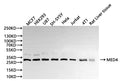 Western Blot, 
Positive WB detected in:MCF7 whole cell lysate(30µg), HEK293 whole cell lysate(30µg), U87 whole cell lysate(30µg), SH-SY5Y whole cell lysate(30µg), Hela whole cell lysate(30µg), Jurkat whole cell lysate(30µg), 4T1 whole cell lysate(30µg), Rat liver tissue lysate(30µg)
All lanes: MED4 antibody at 1:1000
Secondary
Goat polyclonal to rabbit IgG at 1/40000 dilution
Predicted band size: 30 kDa
Observed band size: 30 kDa
Exposure time：10s