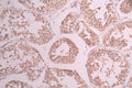 IHC image of CSB-RA563572A0HU diluted at 1:100 and staining in paraffin-embedded human testis tissue performed on a Leica BondTM system. After dewaxing and hydration, antigen retrieval was mediated by high pressure in a citrate buffer (pH 6.0) . Section was blocked with 10% normal goat serum 30min at RT. Then primary antibody (1% BSA) was incubated at 4°C overnight. The primary is detected by a Goat anti-rabbit polymer IgG labeled by HRP and visualized using 0.05% DAB.