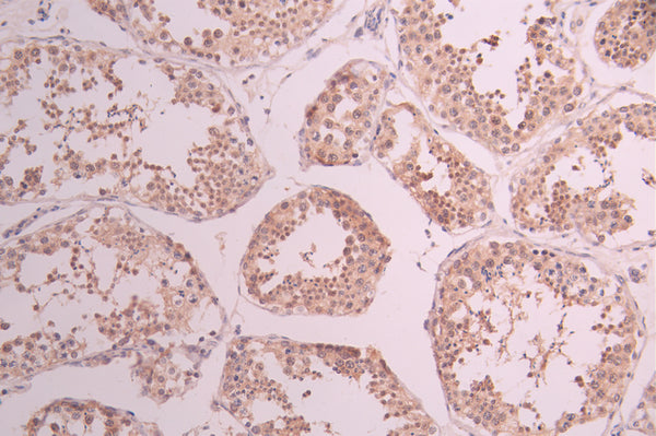 IHC image of CSB-RA563572A0HU diluted at 1:100 and staining in paraffin-embedded human testis tissue performed on a Leica BondTM system. After dewaxing and hydration, antigen retrieval was mediated by high pressure in a citrate buffer (pH 6.0) . Section was blocked with 10% normal goat serum 30min at RT. Then primary antibody (1% BSA) was incubated at 4°C overnight. The primary is detected by a Goat anti-rabbit polymer IgG labeled by HRP and visualized using 0.05% DAB.