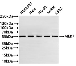 Western Blot
Positive WB detected in: HEK293T whole cell lysate(20µg) ,Hela whole cell lysate(20µg) , HL-60 whole cell lysate(20µg) , Jurkat whole cell lysate(20µg) ,K562 whole cell lysate(20µg) 
All lanes: MEK7 antibody at 1:1000
Secondary
Goat polyclonal to rabbit IgG at 1/40000 dilution
Predicted band size: 47 kDa
Observed band size: 55 kDa
Exposure time：20s