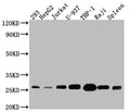 Western Blot
Positive WB detected in: 293 whole cell lysate, HepG2 whole cell lysate, Jurkat whole cell lysate, U-937 whole cell lysate, THP-1 whole cell lysate, Raji whole cell lysate, Mouse Spleen whole cell lysate
All lanes: Bcl-2 antibody at 1:1000
Secondary
Goat polyclonal to rabbit IgG at 1/50000 dilution
Predicted band size: 27, 23 kDa
Observed band size: 27 kDa