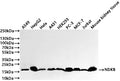 Western Blot
Positive WB detected in: A549 whole cell lysate(30µg) , HepG2 whole cell lysate(30µg) , HeLa whole cell lysate(30µg) , A431 whole cell lysate(30µg) , HEK293 whole cell lysate(30µg) , PC-3 whole cell lysate(30µg) , MCF-7 whole cell lysate(30µg) , Jurkat whole cell lysate(30µg) , Mouse kidney tissue lysate(30µg) 
All lanes: NDKB antibody at 1:1000
Secondary
Goat polyclonal to rabbit IgG at 1/40000 dilution
Predicted band size: 17 kDa
Observed band size: 17 kDa
Exposure time：5s