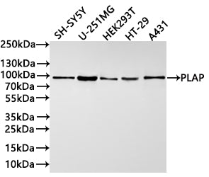 Western Blot
Positive WB detected in: SH-SY5Y whole cell lysate(30µg) , U-251MG whole cell lysate(30µg) , HEK293T whole cell lysate(30µg) , HT-29 whole cell lysate(30µg) , A431 whole cell lysate(30µg) 
All lanes: PLAP antibody at 1:1000
Secondary
Goat polyclonal to rabbit IgG at 1/40000 dilution
Predicted band size: 87 kDa
Observed band size: 87 kDa
Exposure time：1min40s