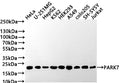 Western Blot
Positive WB detected in: HeLa whole cell lysate(30µg) , U-251MG whole cell lysate(30µg) , HepG2 whole cell lysate, K562 whole cell lysate(30µg) , HEK293 whole cell lysate, A549 whole cell lysate, COLO205 whole cell lysate(30µg) , SH-SY5Y whole cell lysate, Jurkat whole cell lysate(30µg) 
All lanes: PARK7 antibody at 1:1000
Secondary
Goat polyclonal to rabbit IgG at 1/50000 dilution
Predicted band size: 20 kDa
Observed band size: 20 kDa
Exposure time: 2min