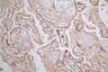 IHC image of CSB-RA566370A0HU diluted at 1:50 and staining in paraffin-embedded human placenta tissue performed on a Leica BondTM system. After dewaxing and hydration, antigen retrieval was mediated by high pressure in a citrate buffer (pH 6.0) . Section was blocked with 10% normal goat serum 30min at RT. Then primary antibody (1% BSA) was incubated at 4°C overnight. The primary is detected by a Goat anti-rabbit polymer IgG labeled by HRP and visualized using 0.15% DAB.