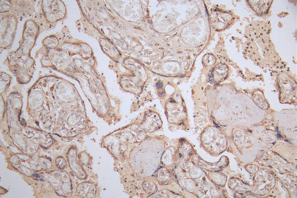 IHC image of CSB-RA566370A0HU diluted at 1:50 and staining in paraffin-embedded human placenta tissue performed on a Leica BondTM system. After dewaxing and hydration, antigen retrieval was mediated by high pressure in a citrate buffer (pH 6.0) . Section was blocked with 10% normal goat serum 30min at RT. Then primary antibody (1% BSA) was incubated at 4°C overnight. The primary is detected by a Goat anti-rabbit polymer IgG labeled by HRP and visualized using 0.15% DAB.