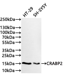Western Blot
Positive WB detected in: HT-29 whole cell lysate(30µg) , SH-SY5Y whole cell lysate(30µg) 
All lanes: CRABP2 polymerase beta antibody at 1:1000
Secondary
Goat polyclonal to rabbit IgG at 1/40000 dilution
Predicted band size: 16 kDa
Observed band size: 16 kDa
Exposure time：2min