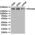 Western Blot
Positive WB detected in: Hela whole cell lysate(30µg), K562 whole cell lysate(30µg), Jurkat whole cell lysate(30µg)
All lanes: Drosha antibody at 1:1000
Secondary
Goat polyclonal to rabbit IgG at 1/40000 dilution
Predicted band size: 159 kDa
Observed band size: 159 kDa
Exposure time：3min
