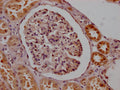 IHC image of CSB-RA567382A0HU diluted at 1:100 and staining in paraffin-embedded human kidney tissue performed on a Leica BondTM system. After dewaxing and hydration, antigen retrieval was mediated by high pressure in a citrate buffer (pH 6.0) . Section was blocked with 10% normal goat serum 30min at RT. Then primary antibody (1% BSA) was incubated at 4℃ overnight. The primary is detected by a Goat anti-rabbit IgG polymer labeled by HRP and visualized using 0.05% DAB.