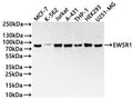 Western Blot
Positive WB detected in: MCF7 whole cell lysate(30µg), K562 whole cell lysate(30µg), Jurkat whole cell lysate(30µg), A431 whole cell lysate(30µg), THP-1 whole cell lysate(30µg), HEK293 whole cell lysate(30µg), U251MG whole cell lysate(30µg)
All lanes:EWSR1 antibody at 1:1000
Secondary
Goat polyclonal to rabbit IgG at 1/40000 dilution
Predicted band size: 68 kDa
Observed band size: 85 kDa
Exposure time：2min