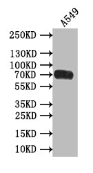 Western Blot
Positive WB detected in: A549 whole cell lysate
All lanes: Poliovirus Receptor antibody at 1:500
Secondary
Goat polyclonal to rabbit IgG at 1/50000 dilution
Predicted band size: 70 kDa
Observed band size: 70 kDa