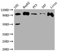 Western Blot
Positive WB detected in: L02 whole cell lysate, HepG2 whole cell lysate, PC-3 whole cell lysate, U-87 whole cell lysate, Rat Liver whole cell lysate
All lanes: ALIX antibody at 1:1000
Secondary
Goat polyclonal to rabbit IgG at 1/50000 dilution
Predicted band size: 97, 97, 31 kDa
Observed band size: 97 kDa