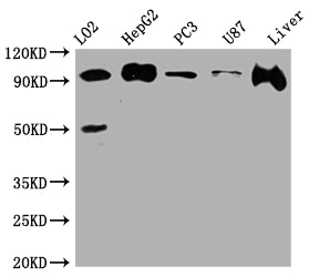 Western Blot
Positive WB detected in: L02 whole cell lysate, HepG2 whole cell lysate, PC-3 whole cell lysate, U-87 whole cell lysate, Rat Liver whole cell lysate
All lanes: ALIX antibody at 1:1000
Secondary
Goat polyclonal to rabbit IgG at 1/50000 dilution
Predicted band size: 97, 97, 31 kDa
Observed band size: 97 kDa