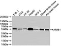 Western Blot
Positive WB detected in: THP-1 whole cell lysate(30µg) , K562 whole cell lysate(30µg) , HT-29 whole cell lysate(30µg) , HepG2 whole cell lysate(30µg) , MCF-7 whole cell lysate(30µg) , Mouse brain tissue lysate(30µg) , Rat brain tissue lysate(30µg) 
All lanes: ARRB1 antibody at 1:1000
Secondary
Goat polyclonal to rabbit IgG at 1/40000 dilution
Predicted band size: 47 kDa
Observed band size: 55 kDa
Exposure time：2min