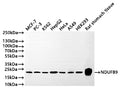Western Blot
Positive WB detected in: MCF-7 whole cell lysate(30µg) , PC-3 whole cell lysate(30µg) , K562 whole cell lysate(30µg) , HepG2 whole cell lysate(30µg) , HeLa whole cell lysate(30µg) , A549 whole cell lysate(30µg) , HEK293 whole cell lysate(30µg) , Rat stomach tissue lysate(30µg) 
All lanes: NDUFB9 antibody at 1:1000
Secondary
Goat polyclonal to rabbit IgG at 1/50000 dilution
Predicted band size: 22 kDa
Observed band size: 22 kDa
Exposure time: 1min
