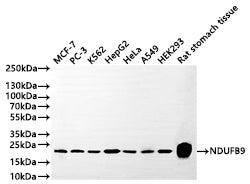Western Blot
Positive WB detected in: MCF-7 whole cell lysate(30µg) , PC-3 whole cell lysate(30µg) , K562 whole cell lysate(30µg) , HepG2 whole cell lysate(30µg) , HeLa whole cell lysate(30µg) , A549 whole cell lysate(30µg) , HEK293 whole cell lysate(30µg) , Rat stomach tissue lysate(30µg) 
All lanes: NDUFB9 antibody at 1:1000
Secondary
Goat polyclonal to rabbit IgG at 1/50000 dilution
Predicted band size: 22 kDa
Observed band size: 22 kDa
Exposure time: 1min
