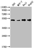 Western Blot
Positive WB detected in: 293 whole cell lysate, MCF-7 whole cell lysate, Raji whole cell lysate, HepG2 whole cell lysate
All lanes: PABPN1 antibody at 1:2000
Secondary
Goat polyclonal to rabbit IgG at 1/50000 dilution
Predicted band size: 33, 32, 38 kDa
Observed band size: 50 kDa