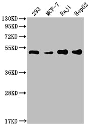 Western Blot
Positive WB detected in: 293 whole cell lysate, MCF-7 whole cell lysate, Raji whole cell lysate, HepG2 whole cell lysate
All lanes: PABPN1 antibody at 1:2000
Secondary
Goat polyclonal to rabbit IgG at 1/50000 dilution
Predicted band size: 33, 32, 38 kDa
Observed band size: 50 kDa