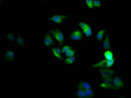 Immunofluorescence staining of Hela Cells with CSB-RA569311A0HU at 1:50, counter-stained with DAPI. The cells were fixed in 4% formaldehyde, permeated by 0.2% TritonX-100, and blocked in 10% normal Goat Serum. The cells were then incubated with the antibody overnight at 4℃. Nuclear DNA was labeled in blue with DAPI. The secondary antibody was FITC-conjugated AffiniPure Goat Anti-Rabbit IgG (H+L) .