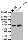 Western Blot
Positive WB detected in: HL-60 whole cell lysate, Rat Liver tissue lysate,
All lanes: HNF-4-alpha antibody at 1:1000
Secondary
Goat polyclonal to rabbit IgG at 1/50000 dilution
Predicted band size: 52 kDa
Observed band size: 52 kDa