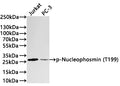 Western Blot
Positive WB detected in: Jurkat whole cell lysate(30µg) , PC-3 whole cell lysate(30µg) 
All lanes: p-Nucleophosmin(T199) antibody at 1:1000
Secondary
Goat polyclonal to rabbit IgG at 1/40000 dilution
Predicted band size: 33 kDa
Observed band size: 28 kDa
Exposure time：1min