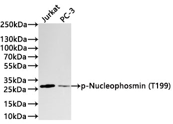 Western Blot
Positive WB detected in: Jurkat whole cell lysate(30µg) , PC-3 whole cell lysate(30µg) 
All lanes: p-Nucleophosmin(T199) antibody at 1:1000
Secondary
Goat polyclonal to rabbit IgG at 1/40000 dilution
Predicted band size: 33 kDa
Observed band size: 28 kDa
Exposure time：1min
