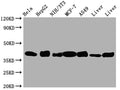 ALDOA Antibody – Figure 1 of 3