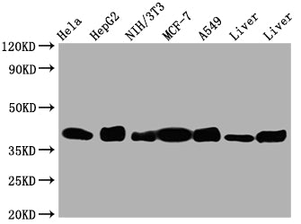 ALDOA Antibody – Figure 1 of 3