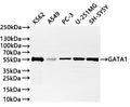Western Blot
Positive WB detected in: K562 whole cell lysate(20µg) ,A549 whole cell lysate(20µg) , PC-3 whole cell lysate(20µg) ,U-251MG whole cell lysate(20µg) ,SH-SY5Y whole cell lysate(20µg) 
All lanes: GATA1 antibody at 1:1000
Secondary
Goat polyclonal to rabbit IgG at 1/40000 dilution
Predicted band size: 43 kDa
Observed band size: 55 kDa
Exposure time：2min