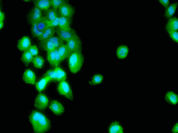 Immunofluorescence staining of A-431 cell with CSB-RA573875A0HU at 1:50 , counter-stained with DAPI. The cells were fixed in 4% formaldehyde, permeabilized using 0.2% Triton X-100 and blocked in 10% normal Goat Serum. The cells were then incubated with the antibody overnight at 4°C. The secondary antibody was Alexa Fluor 488-congugated AffiniPure Goat Anti-Rabbit IgG(H+L).