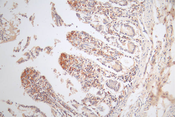IHC image of CSB-RA574653A0HU diluted at 1:80 and staining in paraffin-embedded human small intestine tissue performed on a Leica BondTM system. After dewaxing and hydration, antigen retrieval was mediated by high pressure in a citrate buffer (pH 6.0) . Section was blocked with 10% normal goat serum 30min at RT. Then primary antibody (1% BSA) was incubated at 4°C overnight. The primary is detected by a Goat anti-rabbit polymer IgG labeled by HRP and visualized using 0.49% DAB.