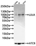 Western Blot
Positive WB detected in: Hela whole cell lysate(30µg) , JK whole cell lysate(30µg) , SY5Y whole cell lysate(30µg) 
All lanes: LDLR antibody at 1:1000
Secondary
Goat polyclonal to rabbit IgG at 1/20000 dilution
Predicted band size: 96 kDa
Observed band size: 100,140 kDa
Exposure time: 60s