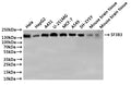 Western Blot
Positive WB detected in: Hela whole cell lysate(30µg), HepG2 whole cell lysate(30µg), A431 whole cell lysate(30µg), U-251MG whole cell lysate(30µg), MCF-7 whole cell lysate(30µg), A549 whole cell lysate(30µg), SH-SY5Y whole cell lysate(30µg), Mouse brain tissue lysate(30µg), Rat brain tissue lysate(30µg)
All lanes: SF3B3 antibody at 1:1000
Secondary
Goat polyclonal to rabbit IgG at 1/40000 dilution
Predicted band size: 136 kDa
Observed band size: 136 kDa
Exposure time：30s