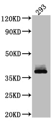 Western Blot
Positive WB detected in: 293 whole cell lysate
All lanes: DKK1 antibody at 1:1000
Secondary
Goat polyclonal to rabbit IgG at 1/50000 dilution
Predicted band size: 29 kDa
Observed band size: 38 kDa