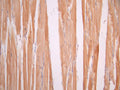 IHC image of CSB-RA577137A0HU diluted at 1:100 and staining in paraffin-embedded human kidney tissue performed on a Leica BondTM system. After dewaxing and hydration, antigen retrieval was mediated by high pressure in a citrate buffer (pH 6.0). Section was blocked with 10% normal goat serum 30min at RT. Then primary antibody (1% BSA) was incubated at 4°C overnight. The primary is detected by a Goat anti-rabbit polymer IgG labeled by HRP and visualized using 0.05% DAB.