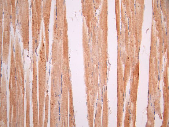 IHC image of CSB-RA577137A0HU diluted at 1:100 and staining in paraffin-embedded human kidney tissue performed on a Leica BondTM system. After dewaxing and hydration, antigen retrieval was mediated by high pressure in a citrate buffer (pH 6.0). Section was blocked with 10% normal goat serum 30min at RT. Then primary antibody (1% BSA) was incubated at 4°C overnight. The primary is detected by a Goat anti-rabbit polymer IgG labeled by HRP and visualized using 0.05% DAB.