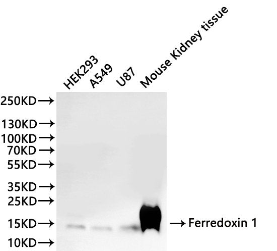 Western Blot
Positive WB detected in: HEK293 whole cell lysate(30µg), A549 whole cell lysate(30µg), U-87MG whole cell lysate(30µg), Mouse kidney tissue lysate(30µg)
All lanes: Ferredoxin 1 antibody at 1:1000
Secondary
Goat polyclonal to rabbit IgG at 1/40000 dilution
Predicted band size: 19 kDa
Observed band size: 13 kDa
Exposure time：2min