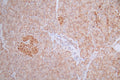 IHC image of CSB-RA577229A0HU diluted at 1:100 and staining in paraffin-embedded human pancreati  tissue performed on a Leica BondTM system. After dewaxing and hydration, antigen retrieval was mediated by high pressure in a citrate buffer (pH 6.0) . Section was blocked with 10% normal goat serum 30min at RT. Then primary antibody (1% BSA) was incubated at 4°C overnight. The primary is detected by a Goat anti-rabbit polymer IgG labeled by HRP and visualized using 0.55% DAB.