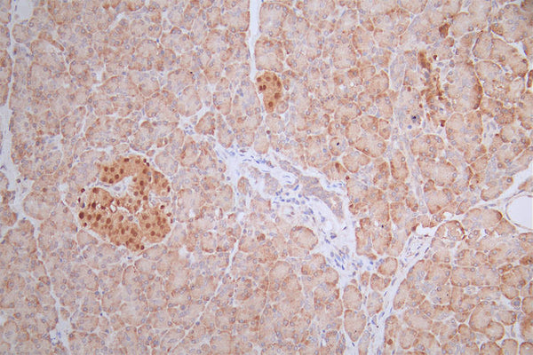 IHC image of CSB-RA577229A0HU diluted at 1:100 and staining in paraffin-embedded human pancreati  tissue performed on a Leica BondTM system. After dewaxing and hydration, antigen retrieval was mediated by high pressure in a citrate buffer (pH 6.0) . Section was blocked with 10% normal goat serum 30min at RT. Then primary antibody (1% BSA) was incubated at 4°C overnight. The primary is detected by a Goat anti-rabbit polymer IgG labeled by HRP and visualized using 0.55% DAB.