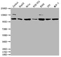 PIK3CA Antibody – Figure 1 of 2