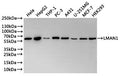 Western Blot
Positive WB detected in: Hela whole cell lysate(30µg), HepG2 whole cell lysate(30µg), THP-1 whole cell lysate(30µg), PC-3 whole cell lysate(30µg), A431 whole cell lysate(30µg), U251 whole cell lysate(30µg), MCF7 whole cell lysate(30µg), HEK293 whole cell lysate(30µg), 
All lanes: LMAN1 antibody at 1:1000
Secondary
Goat polyclonal to rabbit IgG at 1/40000 dilution
Predicted band size: 58 kDa
Observed band size: 58 kDa
Exposure time：1min