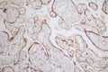 IHC image of CSB-RA579492A0HU diluted at 1:80 and staining in paraffin-embedded human placenta tissue performed on a Leica BondTM system. After dewaxing and hydration, antigen retrieval was mediated by high pressure in a citrate buffer (pH 6.0) . Section was blocked with 10% normal goat serum 30min at RT. Then primary antibody (1% BSA) was incubated at 4°C overnight. The primary is detected by a Goat anti-rabbit polymer IgG labeled by HRP and visualized using 0.48% DAB.