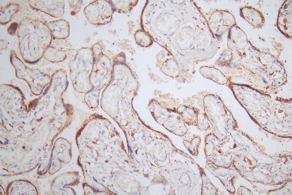 IHC image of CSB-RA579492A0HU diluted at 1:80 and staining in paraffin-embedded human placenta tissue performed on a Leica BondTM system. After dewaxing and hydration, antigen retrieval was mediated by high pressure in a citrate buffer (pH 6.0) . Section was blocked with 10% normal goat serum 30min at RT. Then primary antibody (1% BSA) was incubated at 4°C overnight. The primary is detected by a Goat anti-rabbit polymer IgG labeled by HRP and visualized using 0.48% DAB.