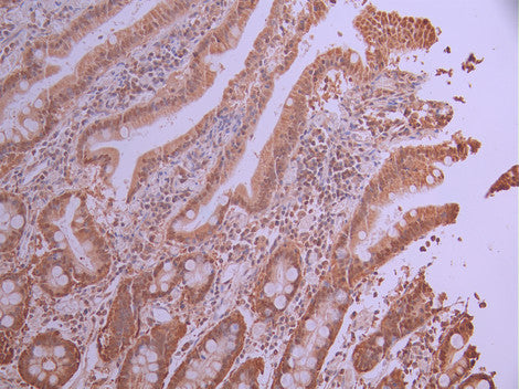 IHC image of CSB-RA580897A0HU diluted at 1:100 and staining in paraffin-embedded human small intestine tissue performed on a Leica BondTM system. After dewaxing and hydration, antigen retrieval was mediated by high pressure in a citrate buffer (pH 6.0) . Section was blocked with 10% normal goat serum 30min at RT. Then primary antibody (1% BSA) was incubated at 4°C overnight. The primary is detected by a Goat anti-rabbit polymer IgG labeled by HRP and visualized using 0.05% DAB.