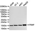 Western Blot
Positive WB detected in: A549 whole cell lysate(30µg) , PC-3 whole cell lysate(30µg) , A431 whole cell lysate(30µg) , HepG2 whole cell lysate(30µg) 
All lanes: TGF alpha antibody at 1:1000
Secondary
Goat polyclonal to rabbit IgG at 1/40000 dilution
Predicted band size: 17 kDa
Observed band size: 15 kDa
Exposure time：2min
