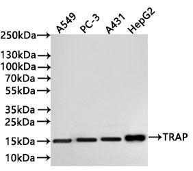 Western Blot
Positive WB detected in: A549 whole cell lysate(30µg) , PC-3 whole cell lysate(30µg) , A431 whole cell lysate(30µg) , HepG2 whole cell lysate(30µg) 
All lanes: TGF alpha antibody at 1:1000
Secondary
Goat polyclonal to rabbit IgG at 1/40000 dilution
Predicted band size: 17 kDa
Observed band size: 15 kDa
Exposure time：2min