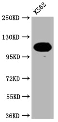 PARP1 Antibody – Figure 1 of 5