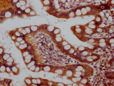 IHC image of CSB-RA581950A0HU diluted at 1:100 and staining in paraffin-embedded human small intestine tissue performed on a Leica BondTM system. After dewaxing and hydration, antigen retrieval was mediated by high pressure in a citrate buffer (pH 6.0) . Section was blocked with 10% normal goat serum 30min at RT. Then primary antibody (1% BSA) was incubated at 4℃ overnight. The primary is detected by a Goat anti-rabbit IgG polymer labeled by HRP and visualized using 0.05% DAB.