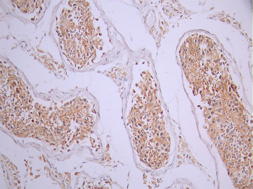 IHC image of CSB-RA582013A0HU diluted at 1:100 and staining in paraffin-embedded human testis tissue performed on a Leica BondTM system. After dewaxing and hydration, antigen retrieval was mediated by high pressure in a citrate buffer (pH 6.0). Section was blocked with 10% normal goat serum 30min at RT. Then primary antibody (1% BSA) was incubated at 4°C overnight. The primary is detected by a Goat anti-rabbit polymer IgG labeled by HRP and visualized using 0.05% DAB.